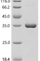 Human Prohibitin-2 (PHB2) Recombinant Protein, C-10His, aa 1–299, in vitro E.coli expression system - BioCrest Sci