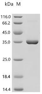 Human Prohibitin-2 (PHB2) Recombinant Protein, C-10His, aa 1–299, in vitro E.coli expression system, Homo sapiens (Human), in vitro E.coli expression system, C-terminal 10xHis-tagged, 34.7 kDa, purity >≥ 95% as determined by SDS-PAGE.