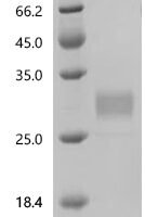 Human Interleukin-33 (IL33), partial, Biotinylated Recombinant Protein - BioCrest Sci
