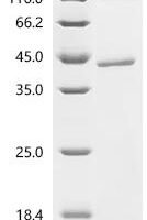 Salmonella typhimurium CDP-abequose synthase (rfbJ) Recombinant Protein - BioCrest Sci