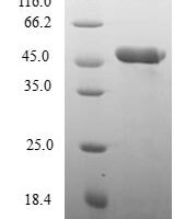 Human Nuclear transcription factor Y subunit beta (NFYB) Recombinant Protein - BioCrest Sci