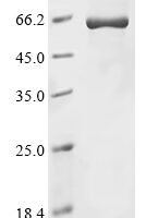 Rabbit Beta-arrestin-1 (ARRB1) Recombinant Protein - BioCrest Sci