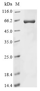 Rabbit Beta-arrestin-1 (ARRB1) Recombinant Protein, RB-Oryctolagus cuniculus (Rabbit), E.coli, N-terminal 6xHis-tagged, 52.3 kDa, purity >≥ 85% as determined by SDS-PAGE.