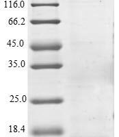 Human Programmed cell death 1 ligand 2 (PDCD1LG2), partial Recombinant Protein - BioCrest Sci