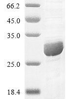 Human Complement component C8 gamma chain (C8G) Recombinant Protein - BioCrest Sci
