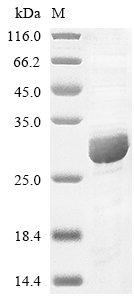 Human Complement component C8 gamma chain (C8G) Recombinant Protein, Homo sapiens (Human), E.coli, N-terminal 6xHis-tagged, 26.4 kDa, purity >≥ 85% as determined by SDS-PAGE.