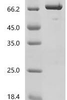 Human 72 kDa type IV collagenase (MMP2) Recombinant Protein - BioCrest Sci