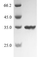 Bacillus velezensis UCMB5033 Chitosanase (csn) Recombinant Protein - BioCrest Sci