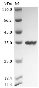 Bacillus velezensis UCMB5033 Chitosanase (csn) Recombinant Protein, Bacillus velezensis UCMB5033, E.coli, N-terminal 10xHis-tagged, 33.4 kDa, purity >≥ 90% as determined by SDS-PAGE.