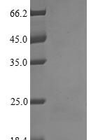Human cytomegalovirus Uncharacterized protein UL128 (UL128) Recombinant Protein, Tag-Free - BioCrest Sci