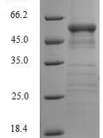 Human Arginase-1 (ARG1) Recombinant Protein - BioCrest Sci