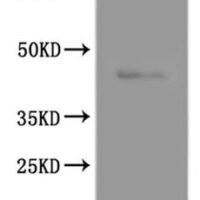 Rat Glutamate receptor ionotropic, NMDA 1 (Grin1), partial-VLPs Recombinant Protein - BioCrest Sci