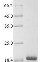 Human A disintegrin and metalloproteinase with thrombospondin motifs 18 (ADAMTS18), partial Recombinant Protein, N-His - BioCrest Sci