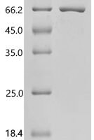 Rat Bifunctional epoxide hydrolase 2 (Ephx2) Recombinant Protein, N-10His/C-Myc - BioCrest Sci
