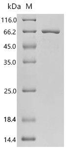 Rat Bifunctional epoxide hydrolase 2 (Ephx2) Recombinant Protein, N-10His/C-Myc, Rattus norvegicus (Rat), E.coli, N-terminal 10xHis-tagged and C-terminal Myc-tagged, 69.8 kDa, purity >≥ 95% as determined by SDS-PAGE.