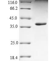 Human Nectin-4 (NECTIN4), partial Recombinant Protein - BioCrest Sci