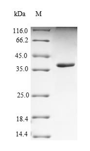 Human Nectin-4 (NECTIN4), partial Recombinant Protein, Homo sapiens (Human), Yeast, N-terminal 6xHis-tagged, 36.1 kDa, purity >≥ 90% as determined by SDS-PAGE.