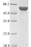Bovine NADPH:adrenodoxin oxidoreductase, mitochondrial (FDXR) Recombinant Protein - BioCrest Sci