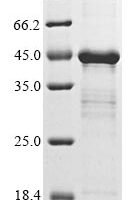 Porphyromonas gingivalis Lys-gingipain HG66 (kgp), partial Recombinant Protein - BioCrest Sci