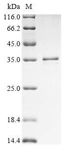 Human Ras-related protein Rab-12 (RAB12) Recombinant Protein, Homo sapiens (Human), E.coli, N-terminal 10xHis-tagged and C-terminal Myc-tagged, 34.7 kDa, purity >≥ 85% as determined by SDS-PAGE.
