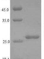 Human Large ribosomal subunit protein P1 (RPLP1) Recombinant Protein - BioCrest Sci