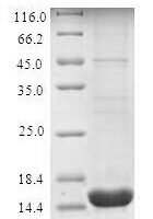 Human Perilipin-4 (PLIN4), partial Recombinant Protein, N-His, aa 308–418, E.coli - BioCrest Sci