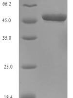 Human N-glycosylase/DNA lyase (OGG1) Recombinant Protein, N-His-SUMO - BioCrest Sci