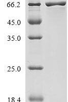 Escherichia coli Transposase for transposon Tn5 (tnpA) (E54K,L372P) Recombinant Protein, N-His-GB1 - BioCrest Sci