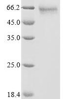 Human Antithrombin-III (SERPINC1)(R294L) Recombinant Protein - BioCrest Sci