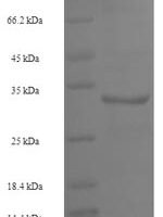 Human U6 snRNA-associated Sm-like protein LSm4 (LSM4) Recombinant Protein - BioCrest Sci