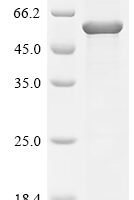 Rabies virus Glycoprotein G (G), partial Recombinant Protein - BioCrest Sci