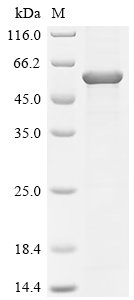 Rabies virus Glycoprotein G (G), partial Recombinant Protein, Rabies virus (strain CVS-11) (RABV), E.coli, C-terminal 6xHis-tagged, 56.6 kDa, purity >≥ 85% as determined by SDS-PAGE.