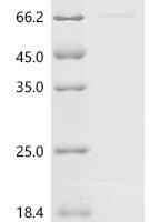 Mouse Putative phospholipase B-like 2 (Plbd2) Recombinant Protein, C-His - BioCrest Sci