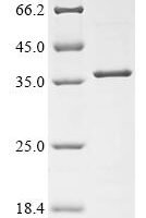 Dog Growth hormone receptor (GHR), partial Recombinant Protein - BioCrest Sci