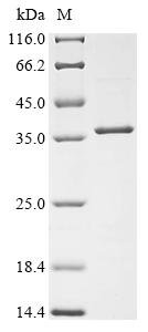 Dog Growth hormone receptor (GHR), partial Recombinant Protein, Canis lupus familiaris (Dog) (Canis familiaris), E.coli, N-terminal 10xHis-tagged and C-terminal Myc-tagged, 35.5 kDa, purity >≥ 90% as determined by SDS-PAGE.