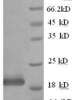 Human Interferon alpha-10 (IFNA10) Recombinant Protein, N-GST - BioCrest Sci