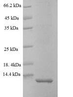 Oncorhynchus mykiss  Myelin proteolipid protein (plp), partial Recombinant Protein - BioCrest Sci
