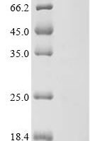 Human Maltase-glucoamylase（MGAM), partial Recombinant Protein - BioCrest Sci
