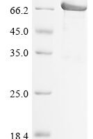Human Desmoglein-2 (DSG2), partial Recombinant Protein, N-His - BioCrest Sci