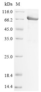 Human Desmoglein-2 (DSG2), partial Recombinant Protein, N-His, Homo sapiens (Human), E.coli, N-terminal 6xHis-tagged, 68.4 kDa, purity >≥ 85% as determined by SDS-PAGE.