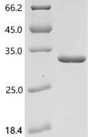 Human Nephrin (NPHS1), partial Recombinant Protein, C-His - BioCrest Sci