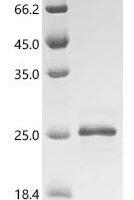 Mouse Adenosine receptor A2a (Adora2a), partial Recombinant Protein - BioCrest Sci