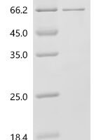 Human L-amino-acid oxidase (IL4I1), partial Recombinant Protein, C-10His - BioCrest Sci