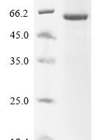 Human Sphingomyelin phosphodiesterase (SMPD1) Recombinant Protein, N-His - BioCrest Sci