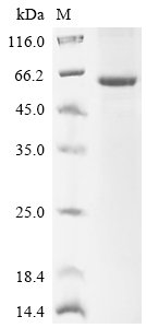 Human Sphingomyelin phosphodiesterase (SMPD1) Recombinant Protein, N-His, Homo sapiens (Human), E.coli, N-terminal 6xHis-tagged, 69.3 kDa, purity >≥ 85% as determined by SDS-PAGE.