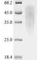 Human RAD51-associated protein 1 (RAD51AP1) Recombinant Protein - BioCrest Sci