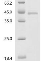 Chicken Protein Wnt-11 (WNT11) Recombinant Protein - BioCrest Sci