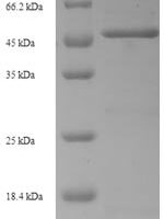 Human Tumor necrosis factor receptor superfamily member 21 (TNFRSF21), partial Recombinant Protein - BioCrest Sci