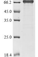 West Nile virus Genome polyprotein, partial Recombinant Protein - BioCrest Sci