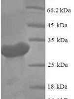 Hepatitis C virus genotype 1a Genome polyprotein, partial Recombinant Protein, N-His-SUMO - BioCrest Sci